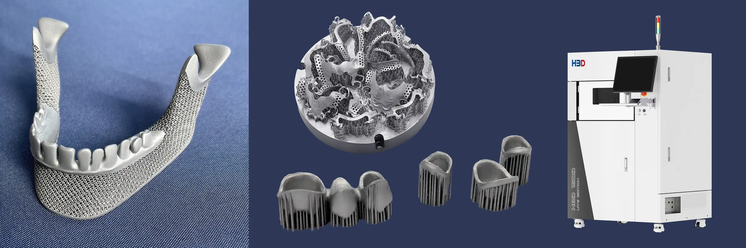 hbd_dentale-prozesskette